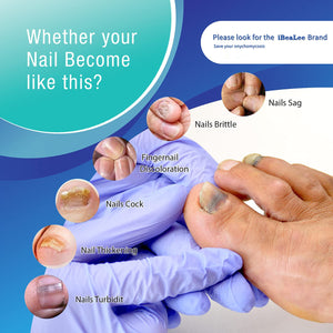 Nail Fungus Treatment | Healthy Nails Herbal Nail Treatment