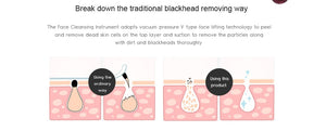 Blackhead + Whitehead Vacuum Facial Suction - High End Miracle Pore Minimizing + Acne Removing Machine