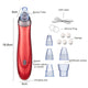 Blackhead + Whitehead Vacuum Facial Suction - High End Miracle Pore Minimizing + Acne Removing Machine