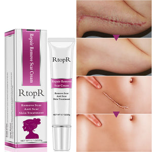 Intense Scar Removal Treatment (Works on Acne Scars Too)